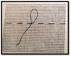 Punct înaintea acului