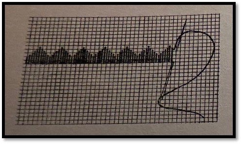 Punctul „La un fir” sau „Peste fire”